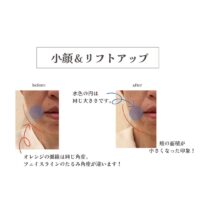 フェイシャル&首デコルテのリンパ流しで小顔に!瞳キラキラでかわいい印象♪