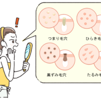 毛穴は減らせない？？毛穴レス肌のつくり方